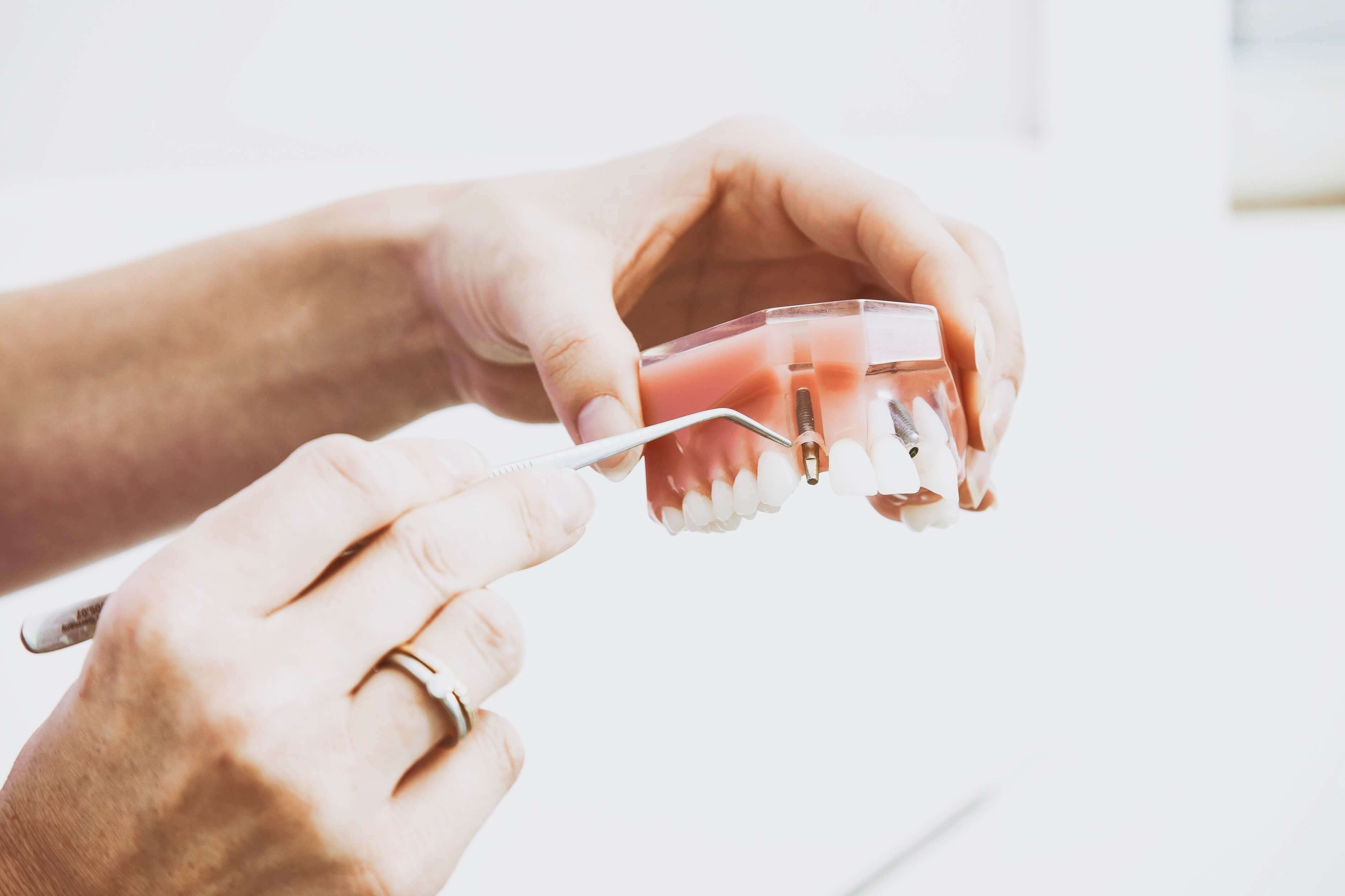 Dental Implant Ontario